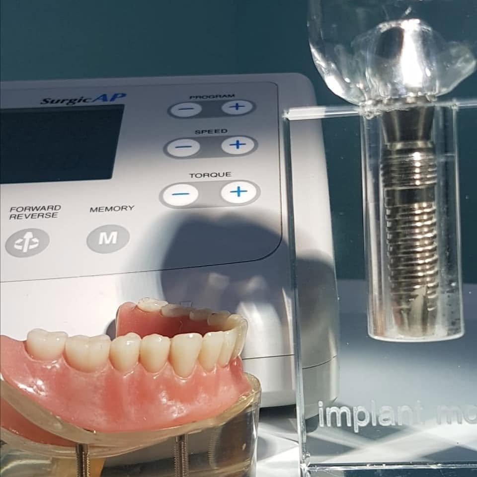 Tratamiento de implantología dental